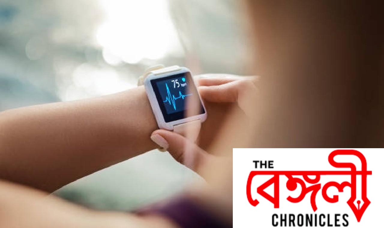 smartwatch
